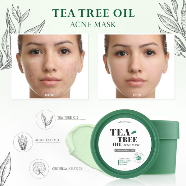 Tea tree oil acne mask โรงงานผลิตเครื่องสำอาง Cosmetic factory